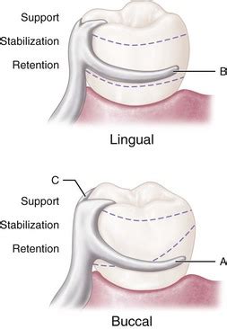 Retainers Direct .